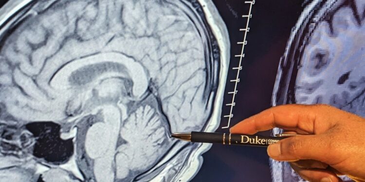 New study finds traumatic stress associated with smaller cerebellum