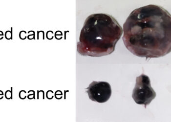 New technology makes it easier for the immune system to detect and destroy cancer