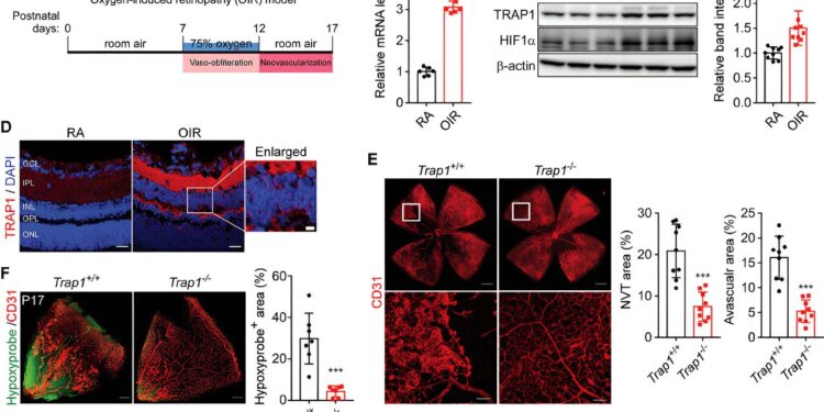 New technology offers promising treatment for ischemic retinopathy