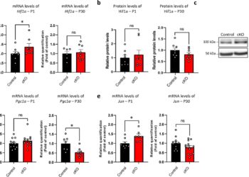 Research finds one of the deleted genes linked to Williams syndrome is responsible for mitochondrial function in the brain