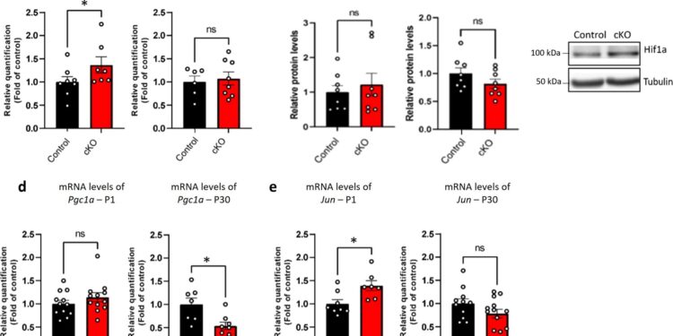 Research finds one of the deleted genes linked to Williams syndrome is responsible for mitochondrial function in the brain