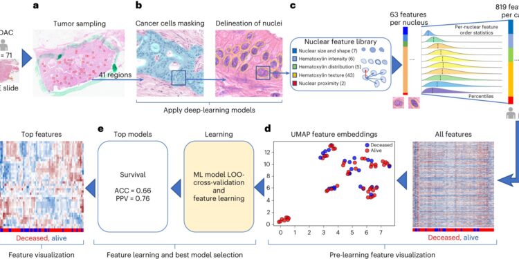Research team develops new tools to improve care for pancreatic cancer patients