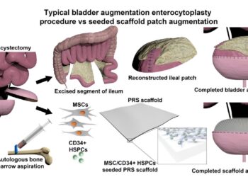 Research team manages to regenerate functional bladder tissue using bone marrow cells