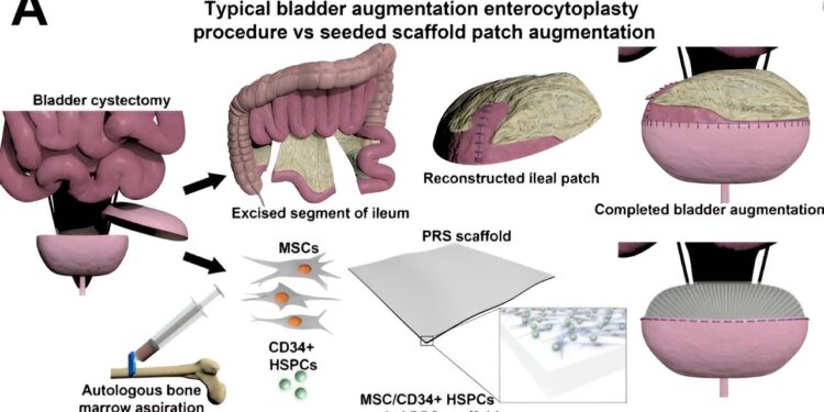 Research team manages to regenerate functional bladder tissue using bone marrow cells
