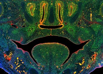 Researchers discover new clues to the cause of craniofacial birth defects