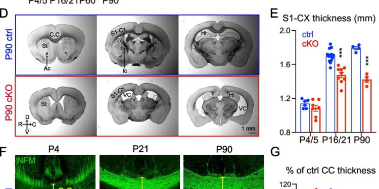 Researchers find enzyme plays much more important role in preventing neurodegenerative diseases