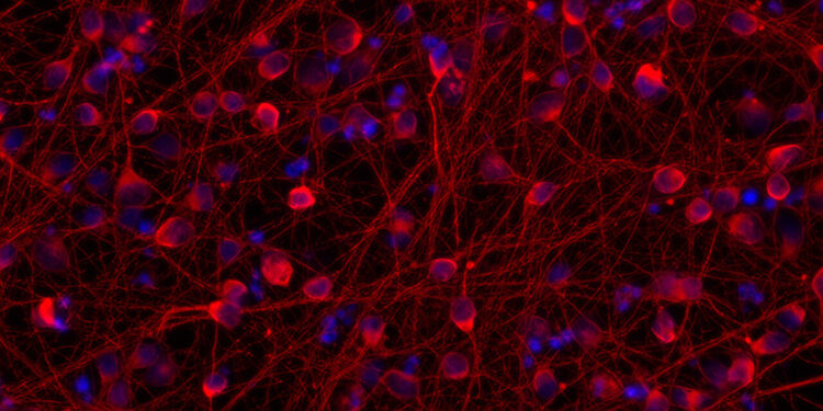 Researchers hack the internal clock of neurons to accelerate the study of neurological diseases