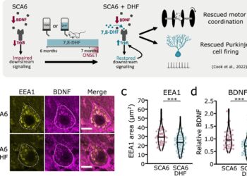 Researchers identify cellular traffic jams in rare neurological disease