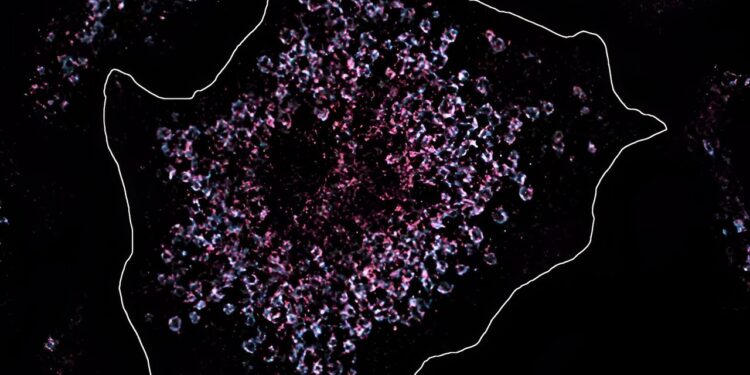 Researchers trace a form of lupus to a single mutation