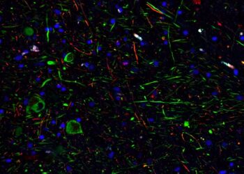 SARS-CoV-2 can infect dopamine neurons causing senescence