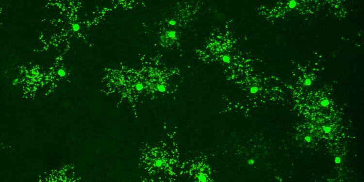 Scientists discover how a subset of neurons allows the eyes to detect movement