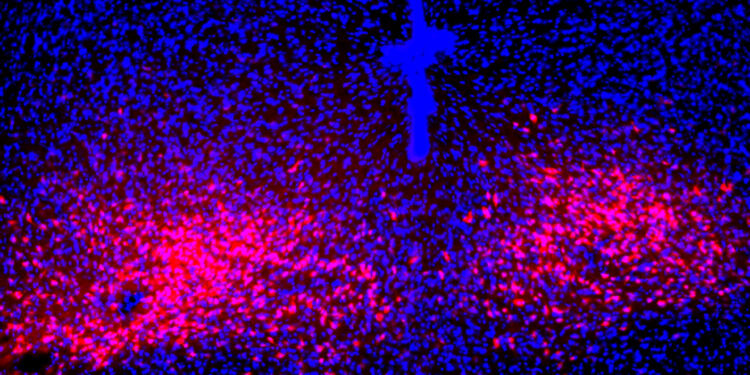 Scientists discover key brain pathway mediating panic disorder symptoms