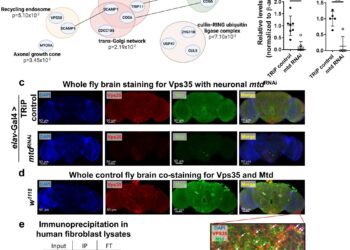 Scientists identify how dietary restrictions slow brain aging and increase lifespan