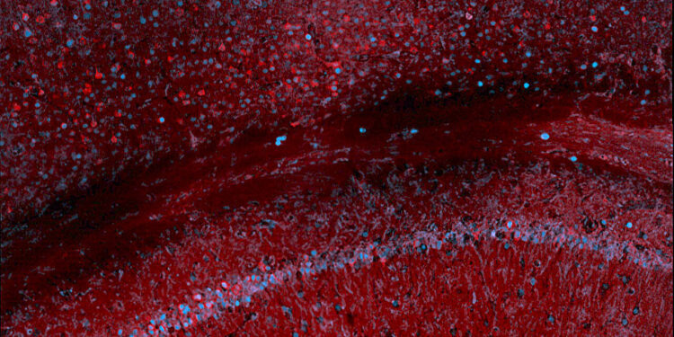 Scientists use blood tests to track gene expression in the brain