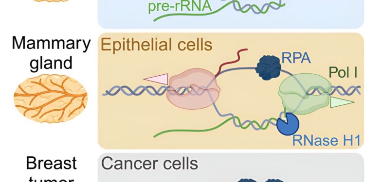 Special RNA has been shown to suppress the formation of breast cancer cells