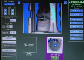 Study provides insight into depression via ophthalmology