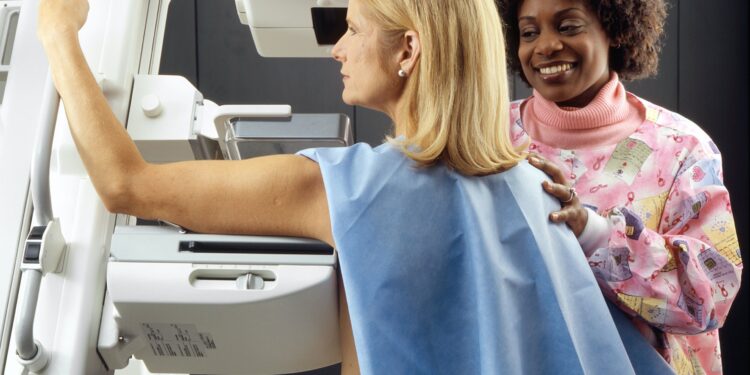 Study shows breast cancer rates are increasing in younger women