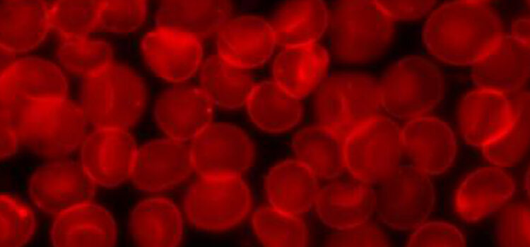 Team develops bioengineered material to quickly stop bleeding in patients taking blood thinners