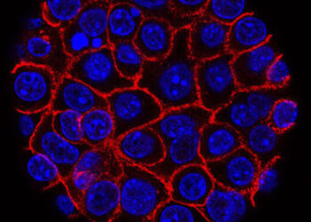 Vaccine demonstrates potential to delay relapse of KRAS-mutated pancreatic and colorectal cancers