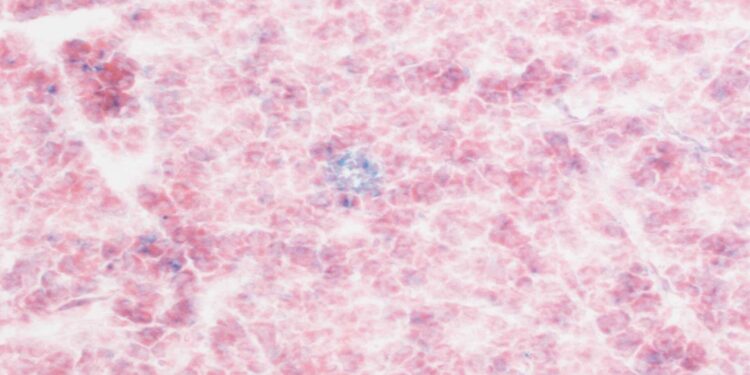 With modification, CAR T cells can attack senescent cells, leading to slower aging in mice