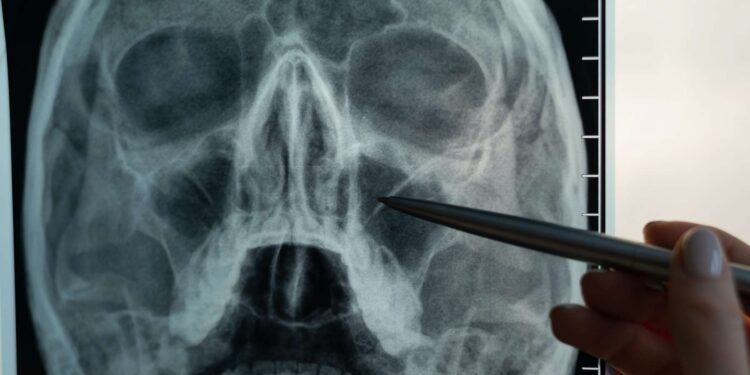 a foul odor reveals a bullet stuck in his nose for eight years