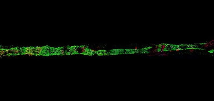 A “heart-on-a-chip” to test the cardiac toxicity of chemotherapies and other anticancer drugs