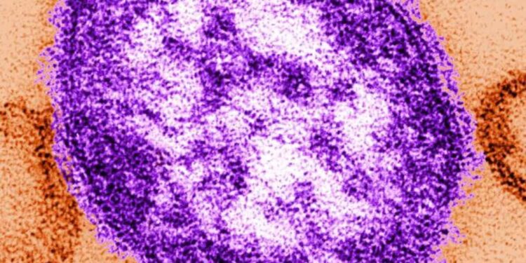 Florida and measles: please move backwards