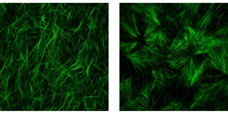 For diabetes and liver cancer, study suggests new screening guidelines