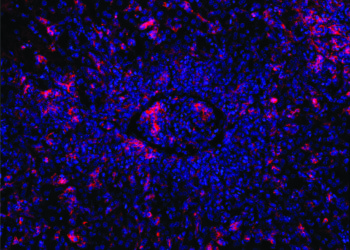 Gene editing precisely repairs immune cells