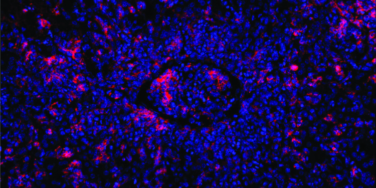 Gene editing precisely repairs immune cells