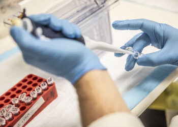 High-fiber diet may delay clinical onset of Huntington’s disease, study finds