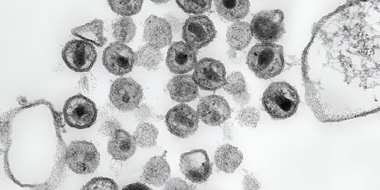 How a new drug pushes the HIV capsid to the breaking point