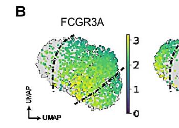 Immune cells lose their ‘killer instinct’ in cancer tumors, but their functionality can be reawakened