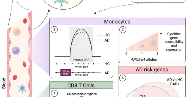 Immune genes are altered in the blood of Alzheimer’s patients
