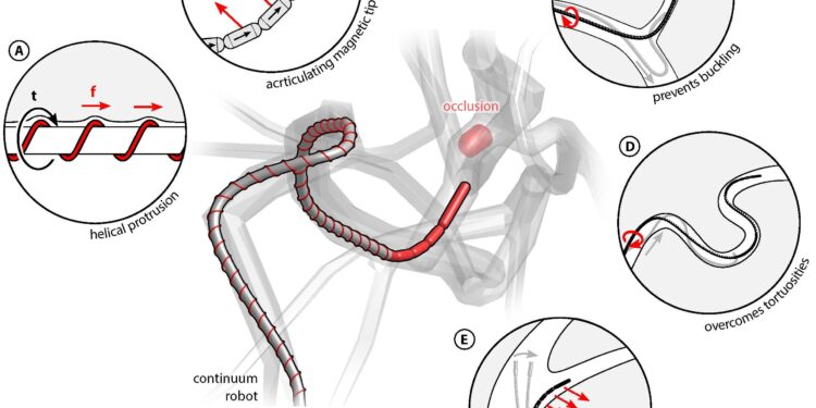Magnetically controlled robot can move through arteries to treat stroke patients