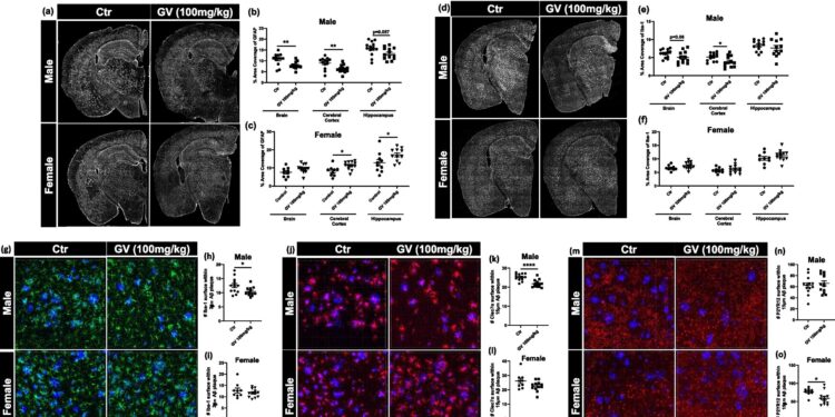 Microbiome studies explore why more women develop Alzheimer’s disease