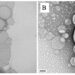 Nanoparticles containing a natural substance treat visceral leishmaniasis with few side effects
