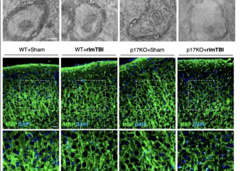 New drug could protect brain from damage caused by repeated concussions