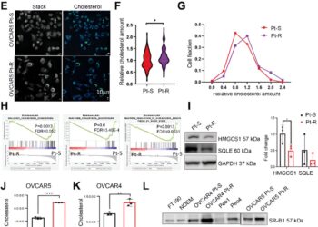 Outwitting chemoresistant ovarian cancer with nanoparticle treatment