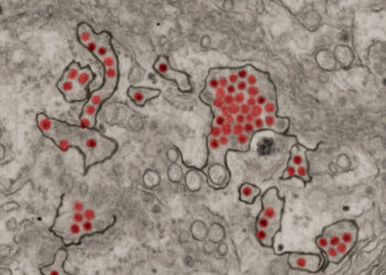 Previous Zika infection increases risk of severe dengue fever and subsequent hospitalization, study concludes