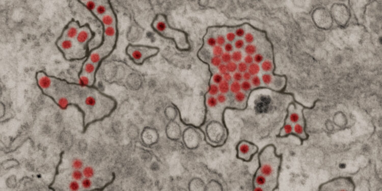 Previous Zika infection increases risk of severe dengue fever and subsequent hospitalization, study concludes