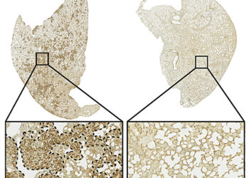 Promising results in cancer treatment thanks to immunotherapy and Danish technology