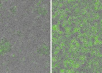 Promising target for CAR T cell therapy leads to powerful anti-tumor responses against cutaneous and rare melanomas