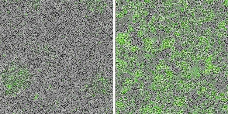 Promising target for CAR T cell therapy leads to powerful anti-tumor responses against cutaneous and rare melanomas