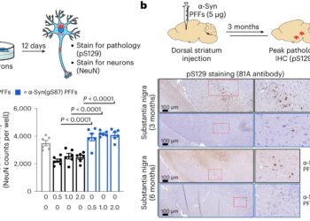 Protein modifications found to be key influencers in neurodegenerative diseases