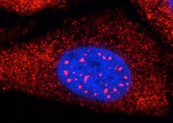 Protein production problems in Huntington’s disease revealed