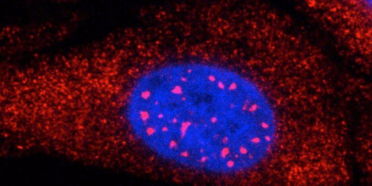 Protein production problems in Huntington’s disease revealed