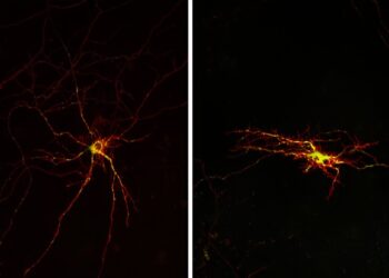 Researchers discover molecular mechanism linked to neuronal death