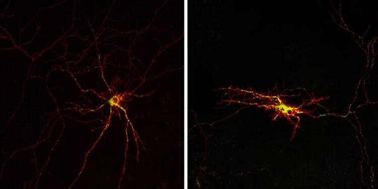 Researchers discover molecular mechanism linked to neuronal death
