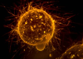Researchers discover that epigenetic status determines metastasis
